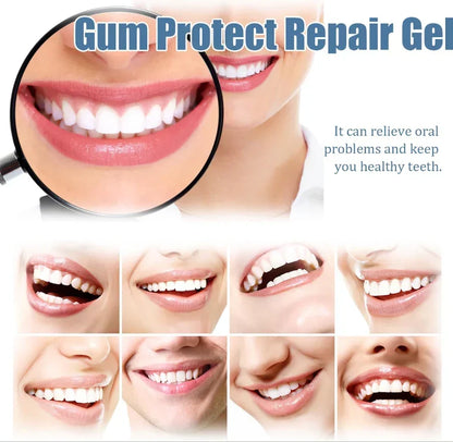【New upgrade】Caelvya Gum Protect Dental Repair Gel【3 tubes/box】