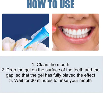【New upgrade】Caelvya Gum Protect Dental Repair Gel【3 tubes/box】